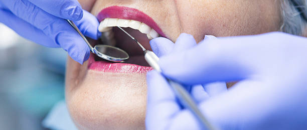 Best Urgent Care for Lost Fillings or Crowns in New Orleans Station, LA